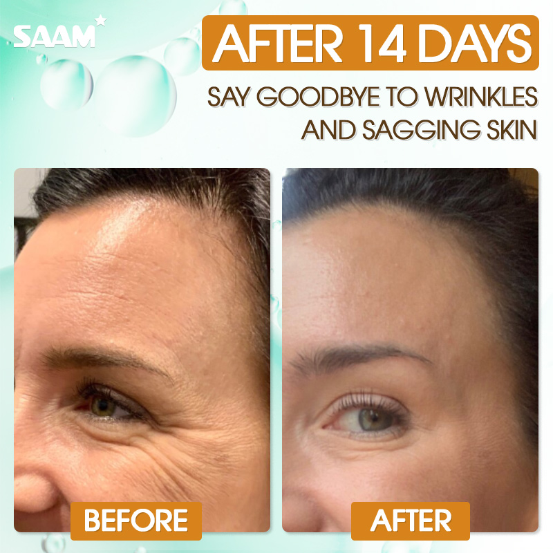 Nourish your skin for a healthy complexion with SAAM Serum 1