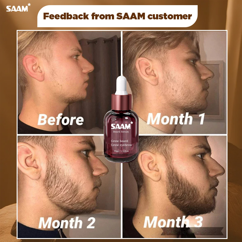 Journey of growing beard and achieving expected results of a customer