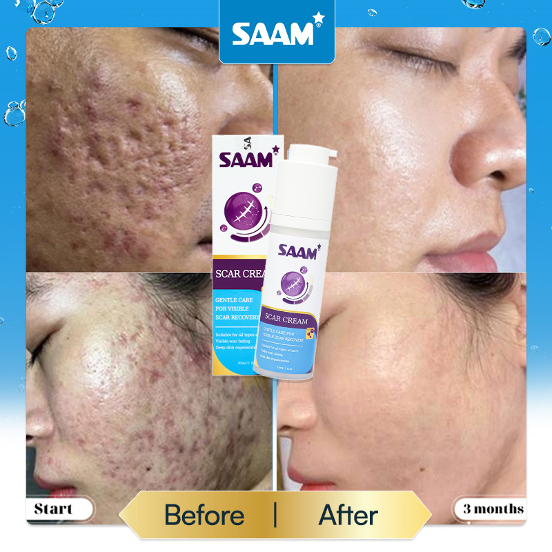 Customer's skin condition improved after using SAAM product (1)