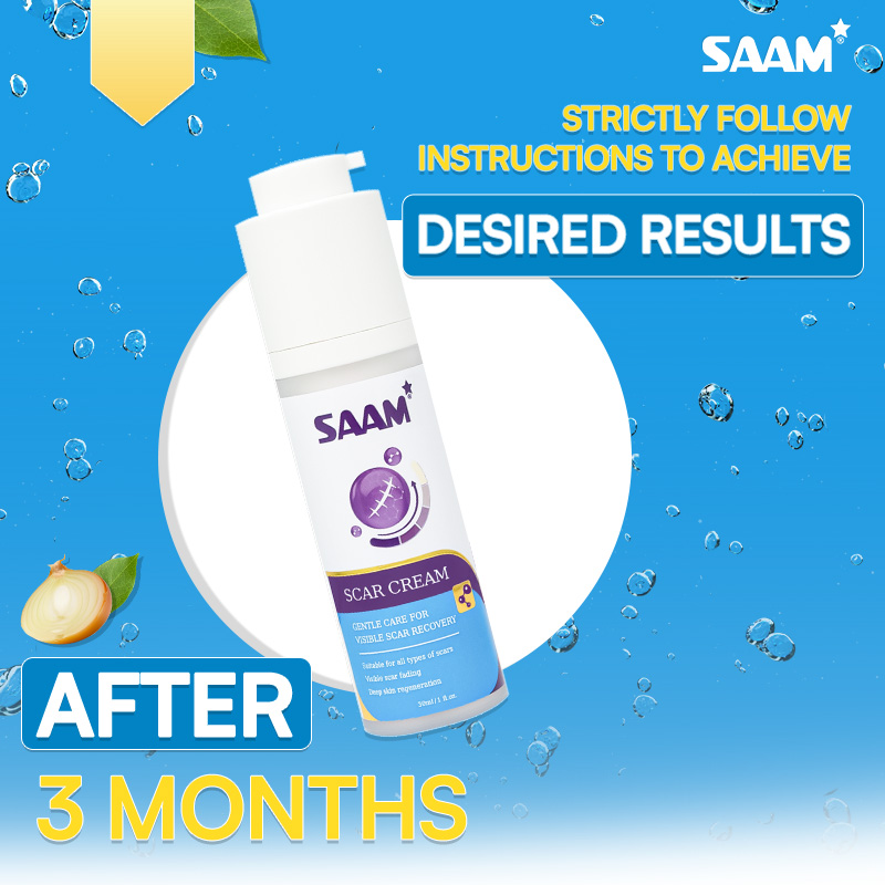 Follow SAAM's instructions to achieve the expected results (1)