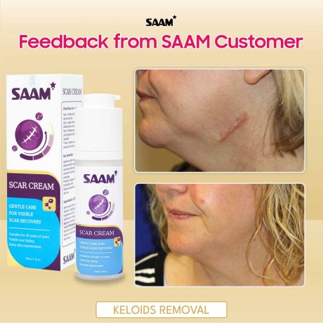 SAAM-Scar-Cream-5
