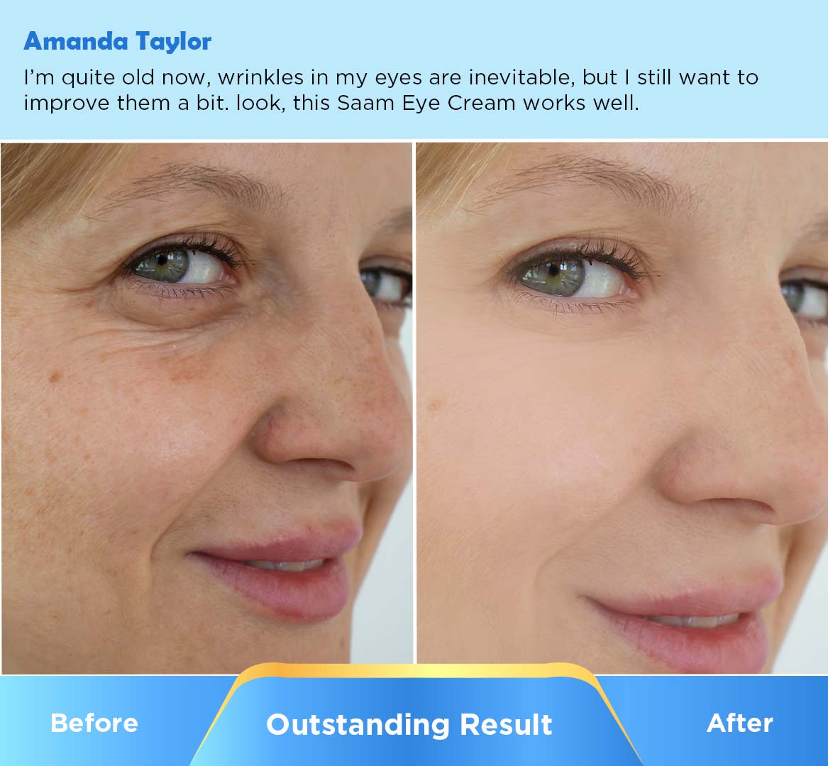 Combat visible signs of aging in the eye area (1)