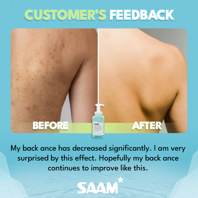 Consistently use SAAM Body Wash properly to help maintain comfortable skin