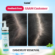SAAM Dandruff Shampoo 150ml Soothe and Cleanse Scalps