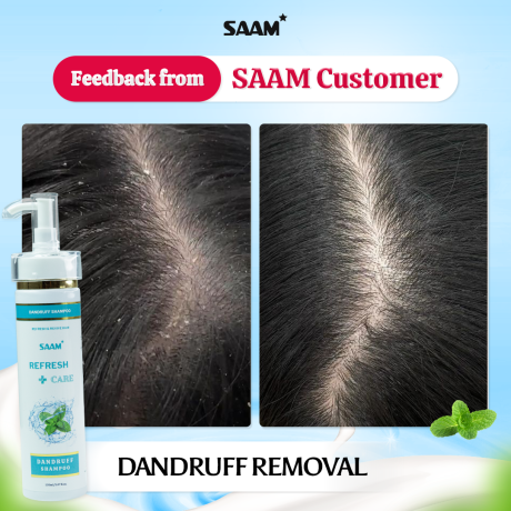 Dandruff-Shampoo-6-1