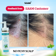 SAAM Dandruff Shampoo 150ml Soothe and Cleanse Scalps
