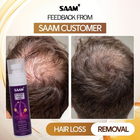 SAAM-Ultra-Hair-Growth-Spray-5