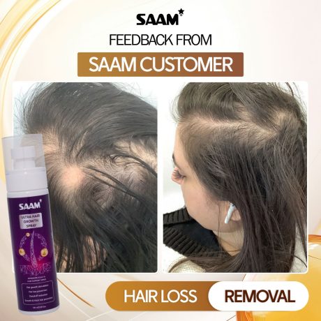 SAAM-Ultra-Hair-Growth-Spray-6