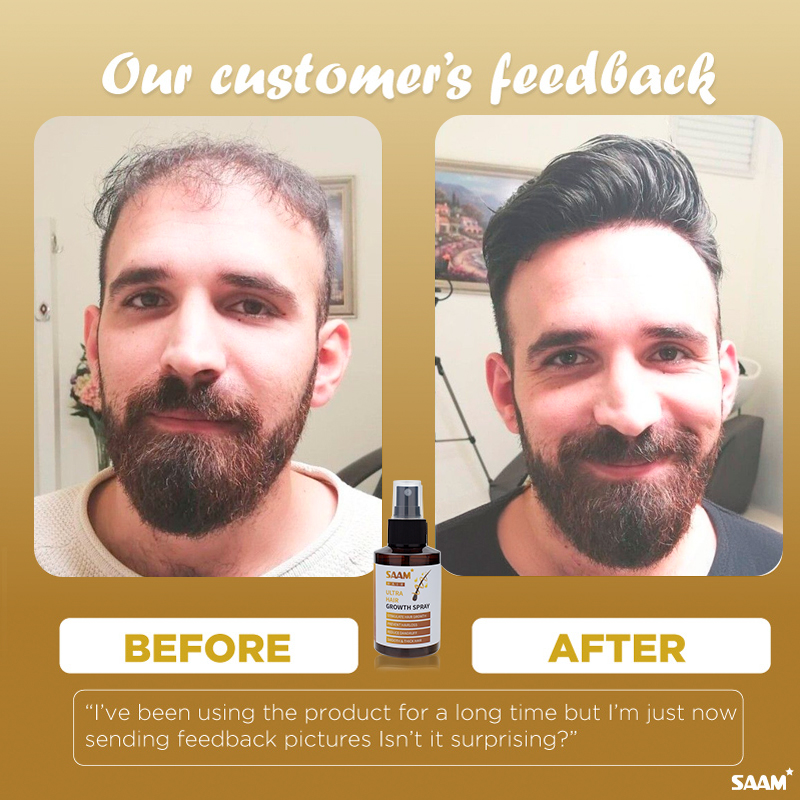SAAM customer feedbacks after using this shampoo