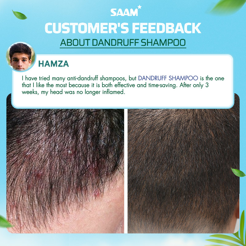The customer's scalp was healthier by using this shampoo