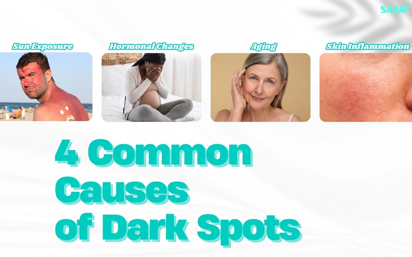 4 common causes of dark spots you should know