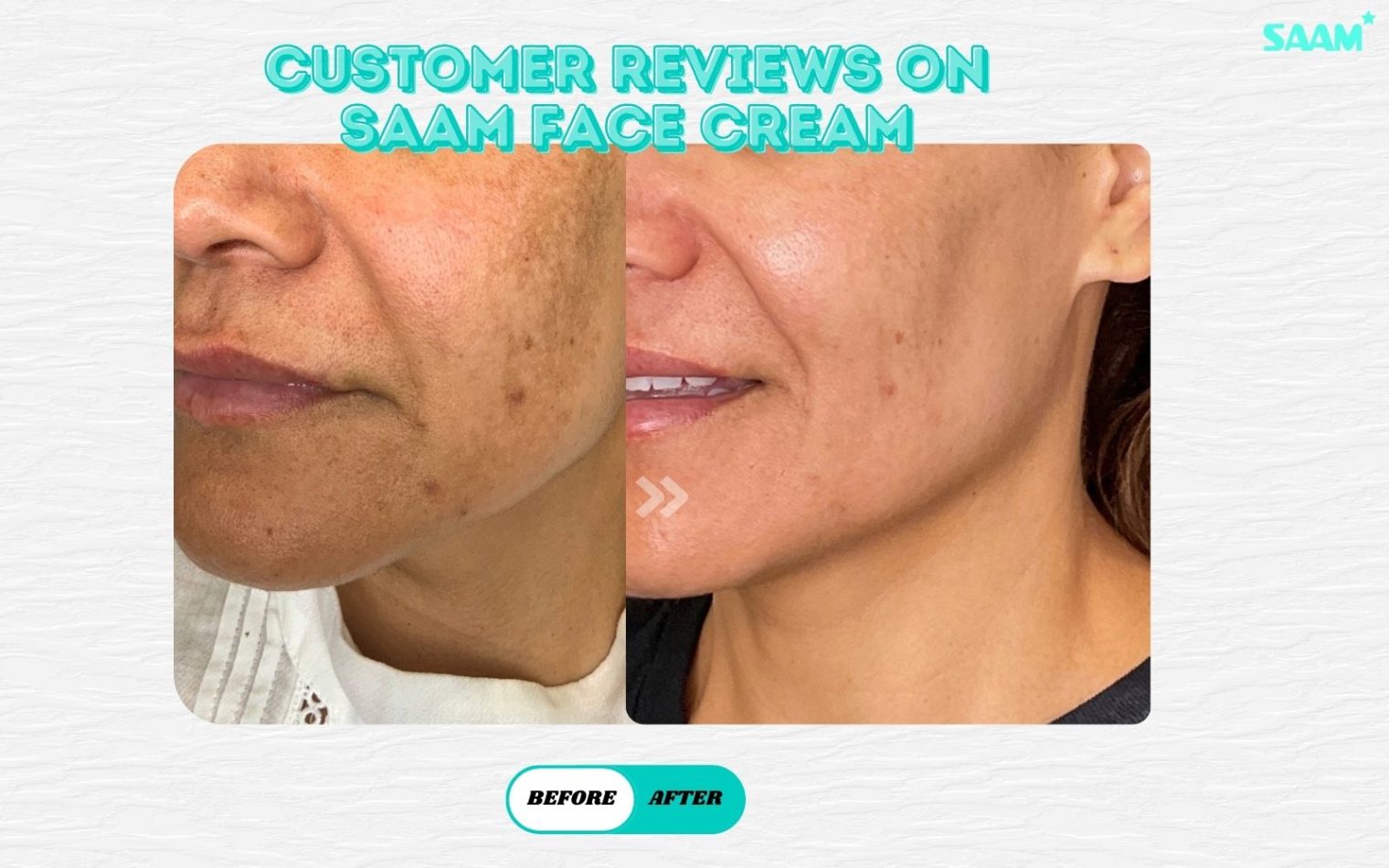 Customer review after using this face cream for hyperpigmentation