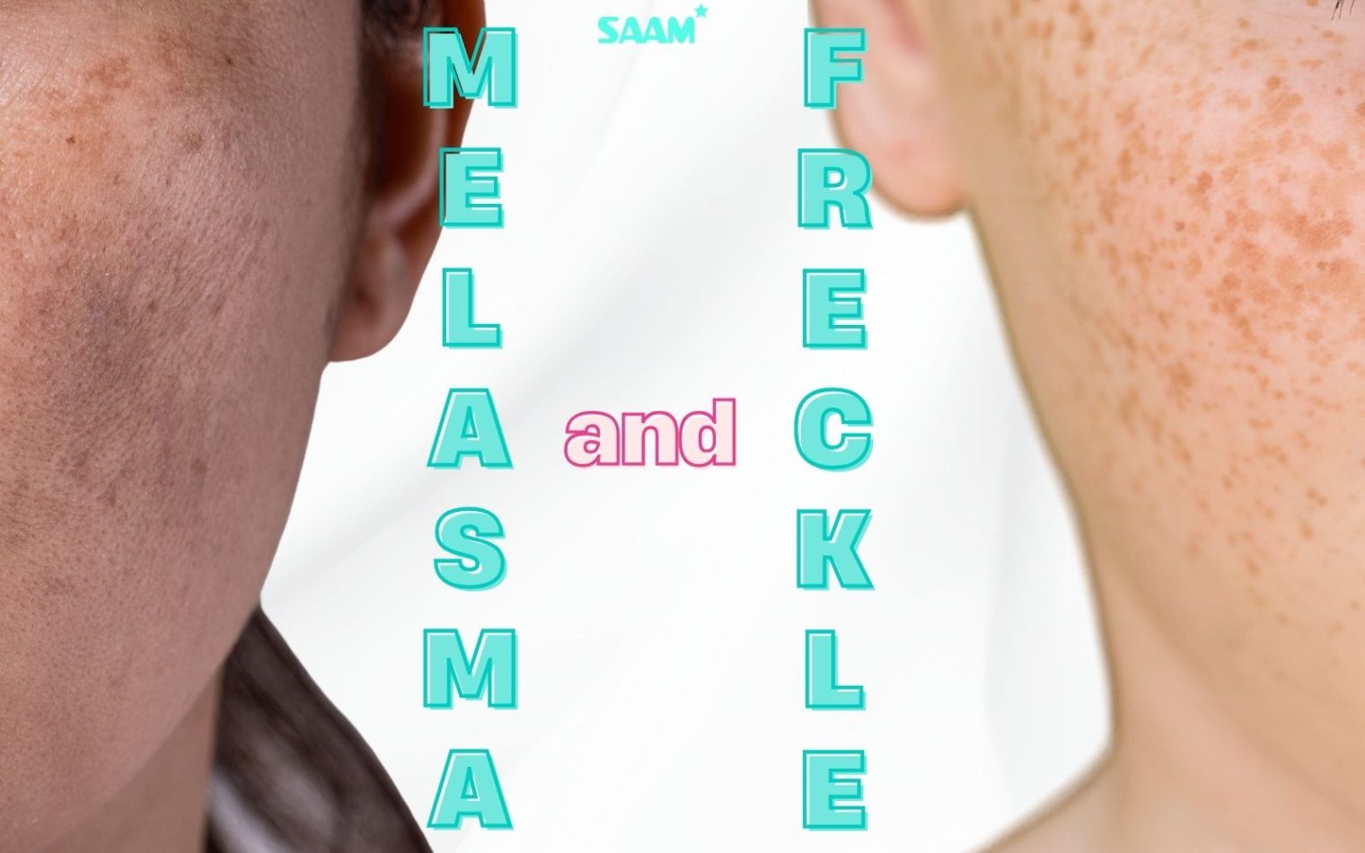 Explore the difference between melasma and freckles