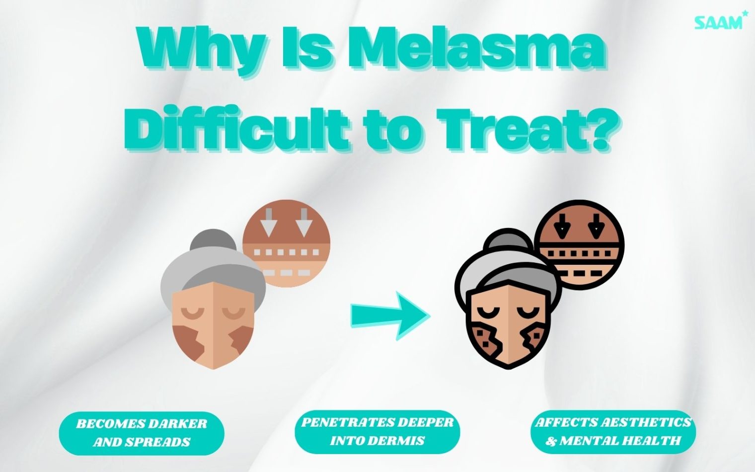Explore the reason why melasma is difficult to treat