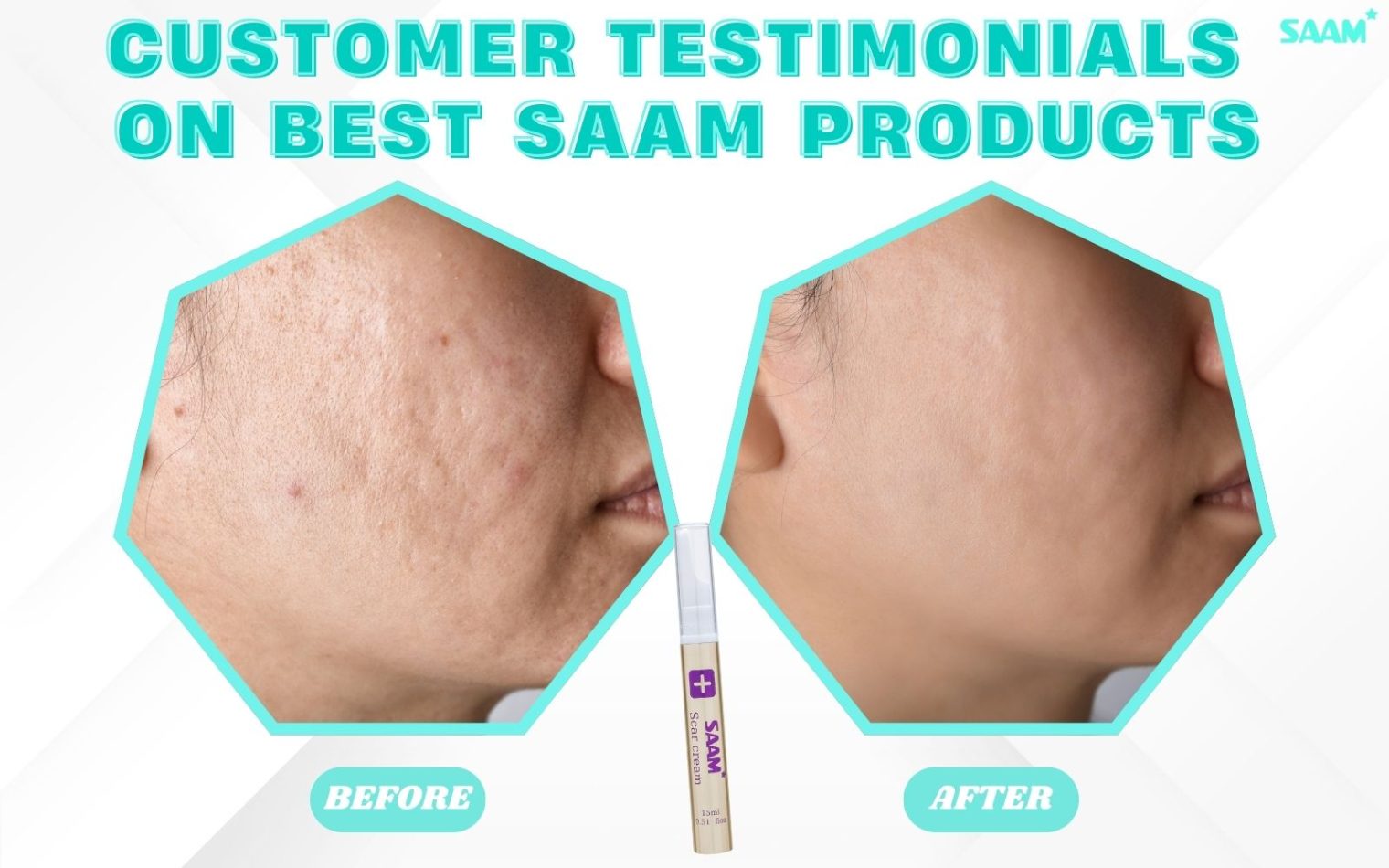 Feedback from customer after using Scar Cream