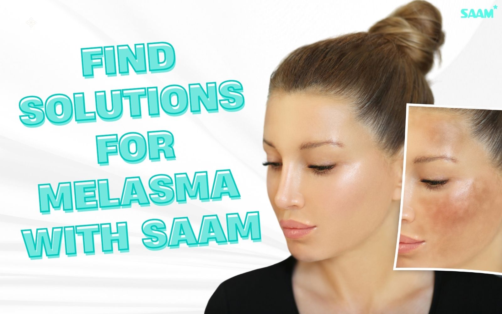 Find solutions for melasma with SAAM