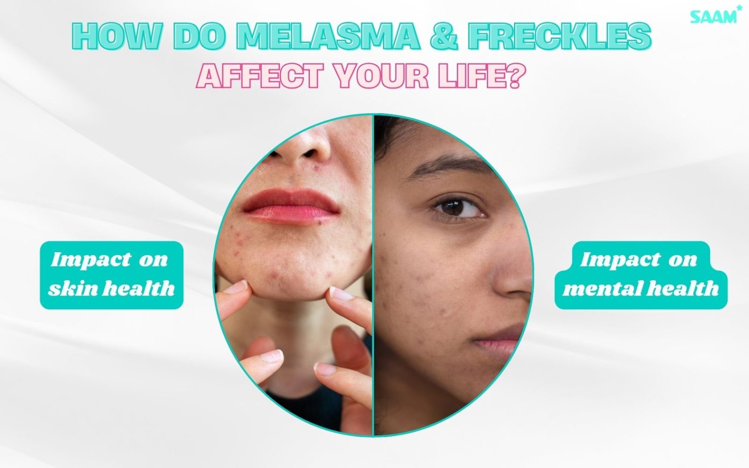 How do melasma and freckles affect your life