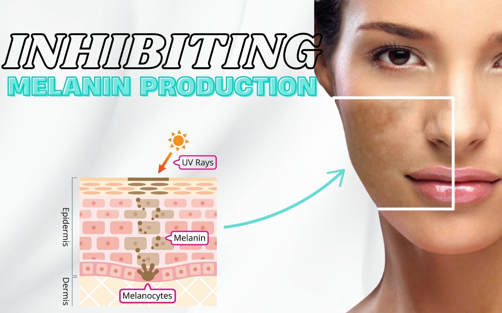 Inhibiting melanin overproduction