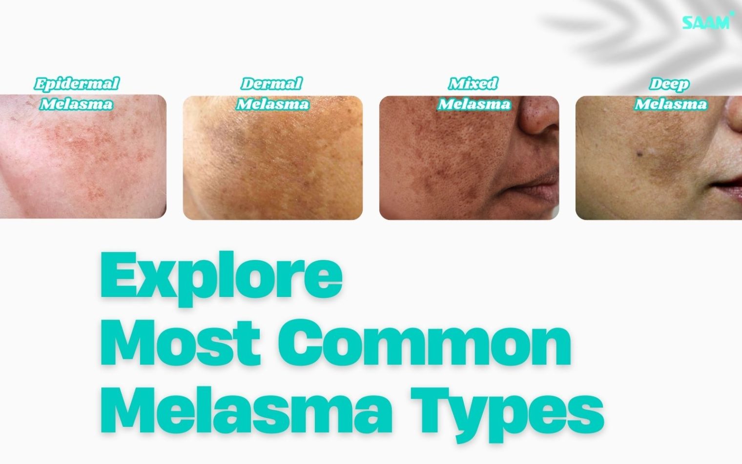 Know 4 most common types