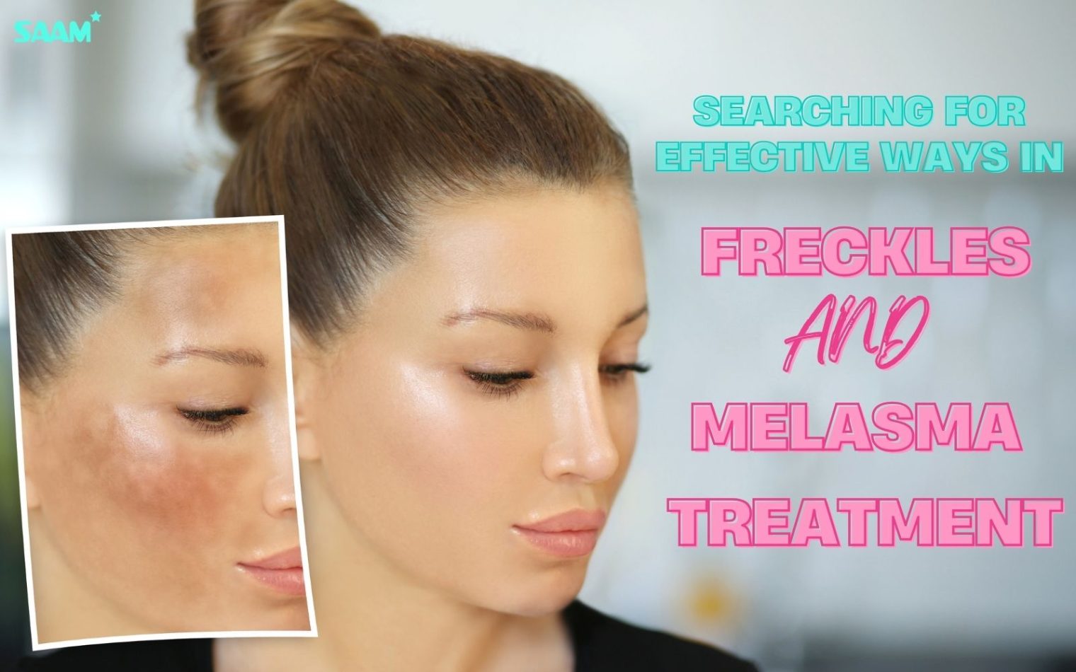 Searching for effective ways in freckles and melasma treatment