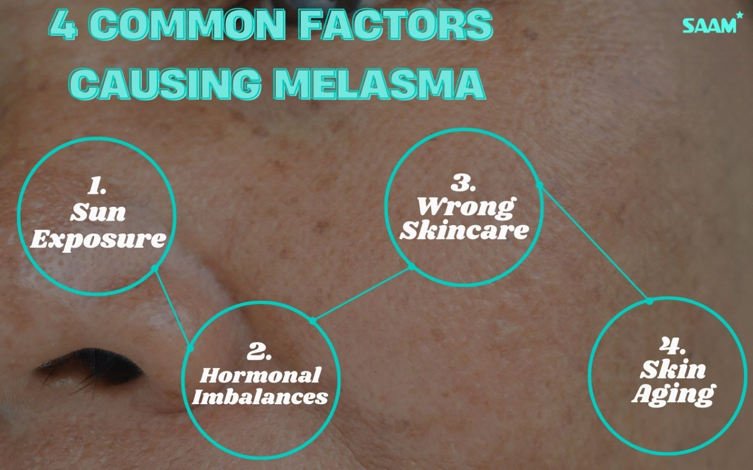 Understading melanin and freckles causes for better treatment 2