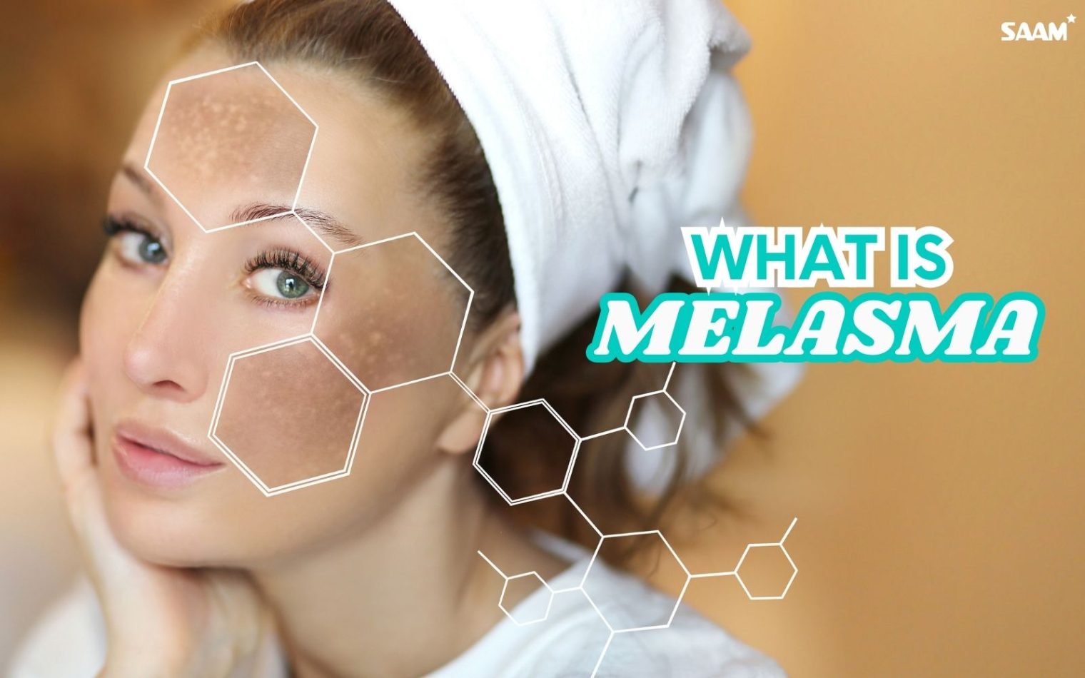 Understanding melasma and find suitable solution to treat them