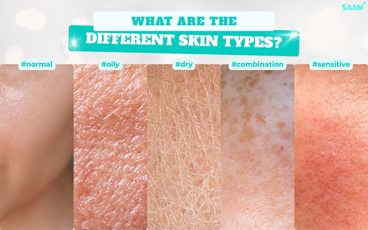 Skin is categorized into five main types