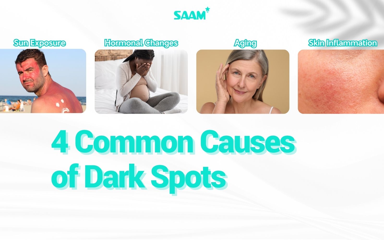 4 common causes of dark spots you should know (1)