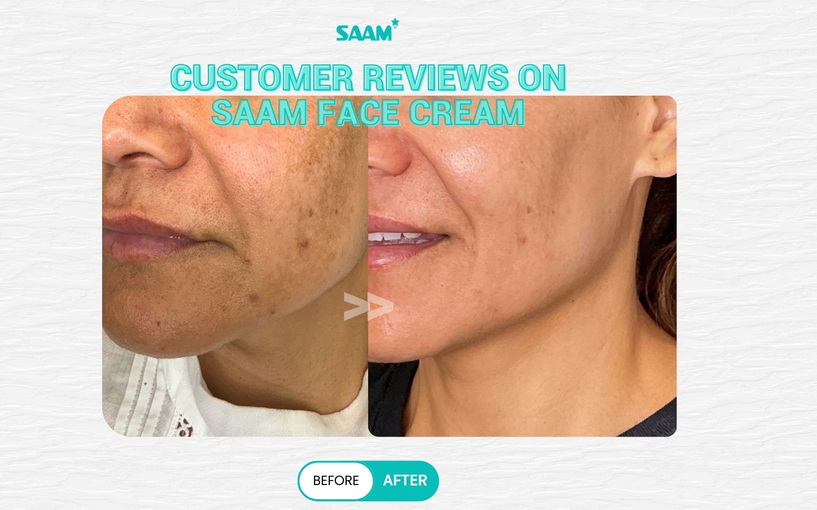 Customer review after using this face cream for hyperpigmentation (1)