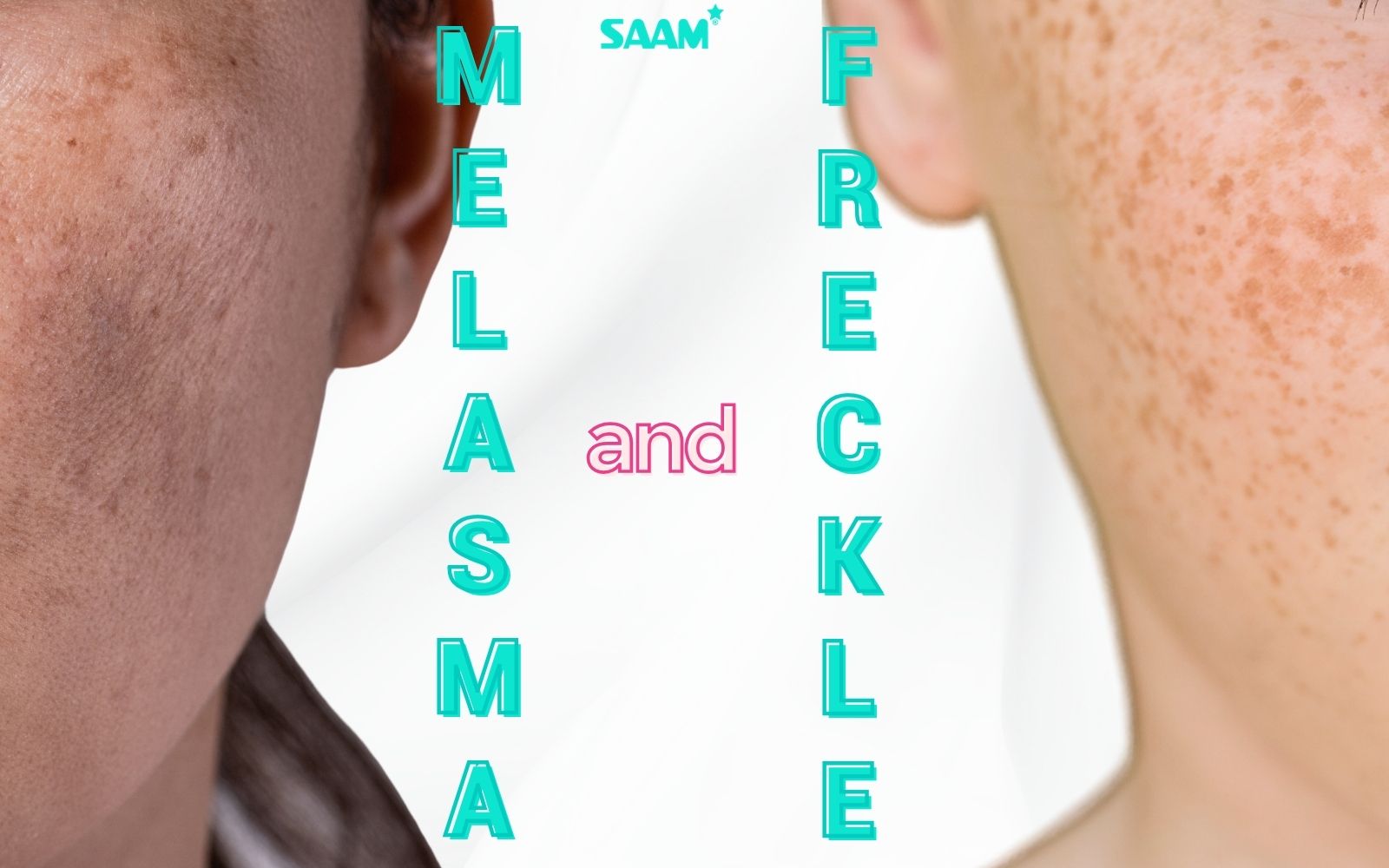 Explore the difference between melasma and freckles (1)