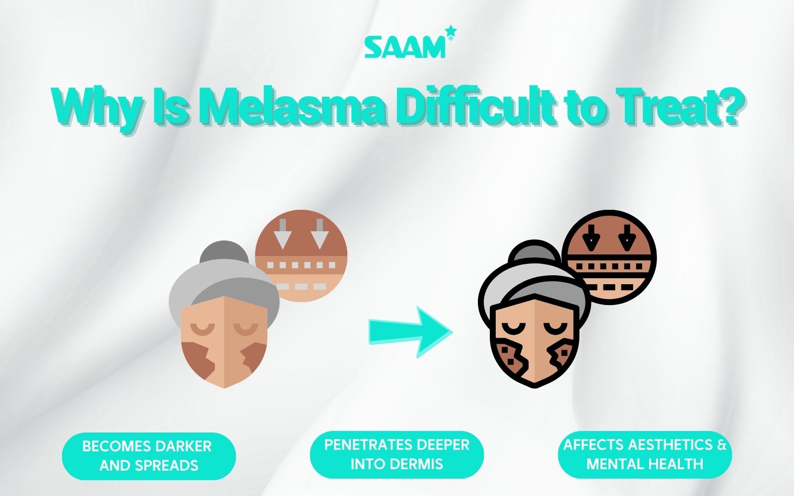Explore the reason why melasma is difficult to treat (1)
