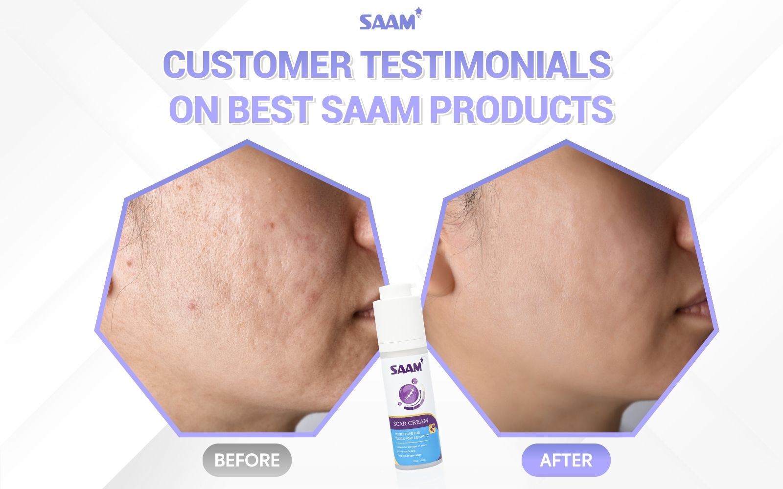 Feedback from customer after using Scar Cream (1)