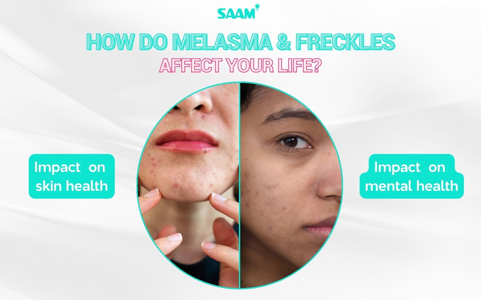How do melasma and freckles affect your life? (1)