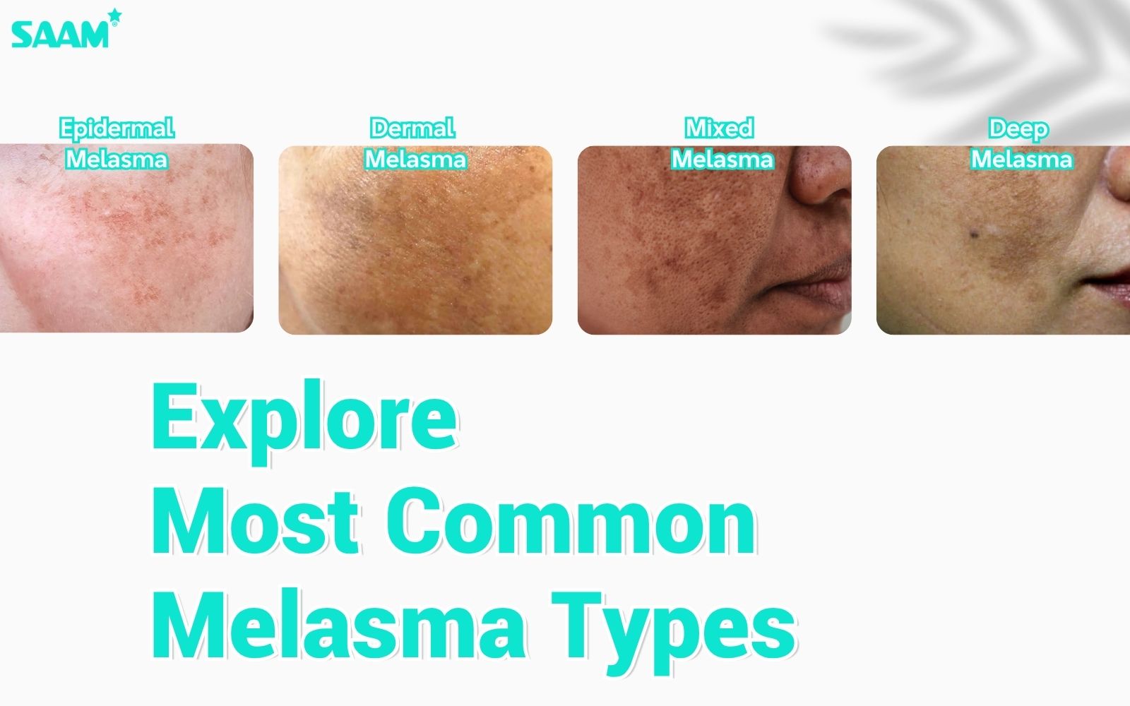 Know 4 most common types