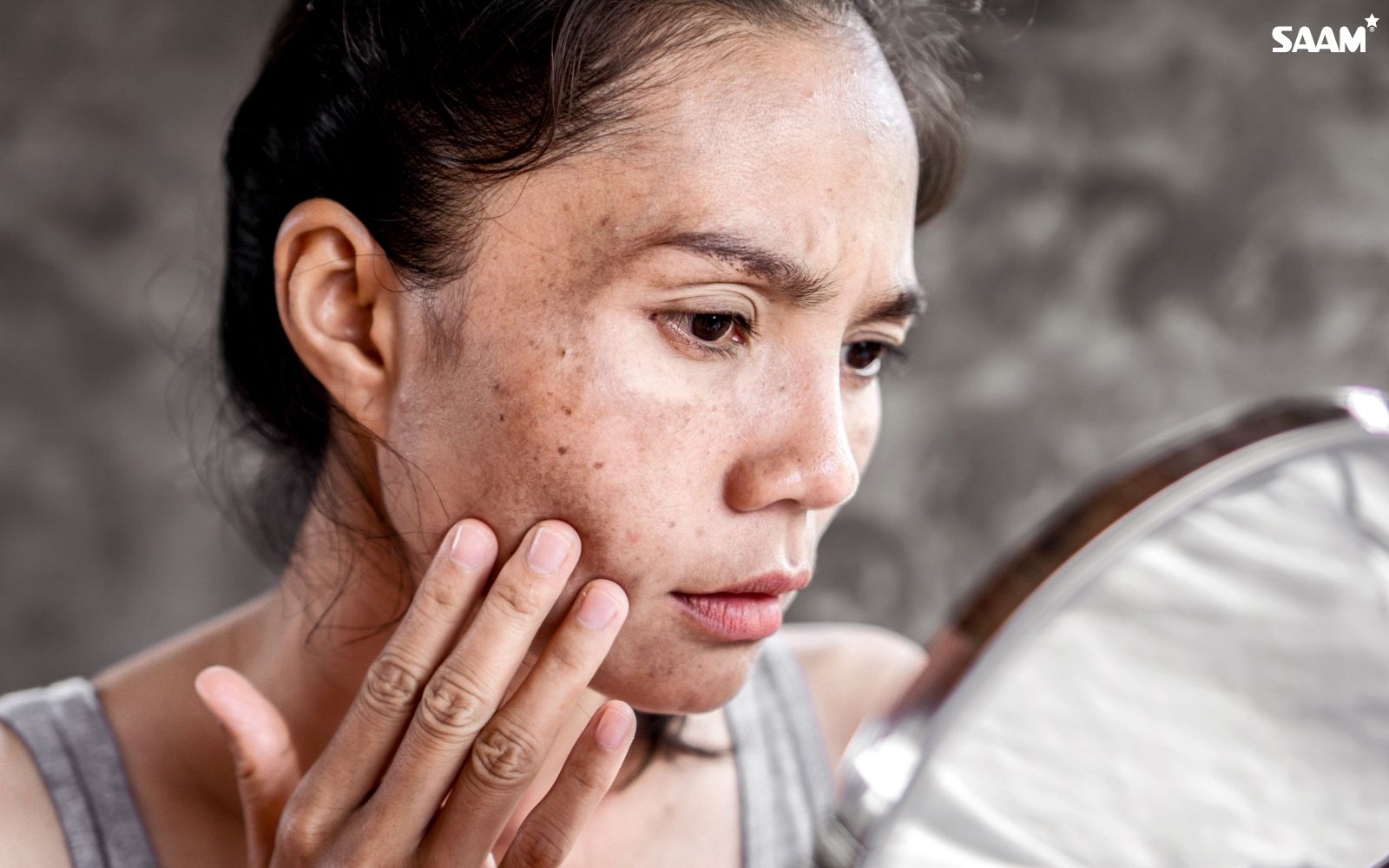 Never let these skin problems affect your confidence