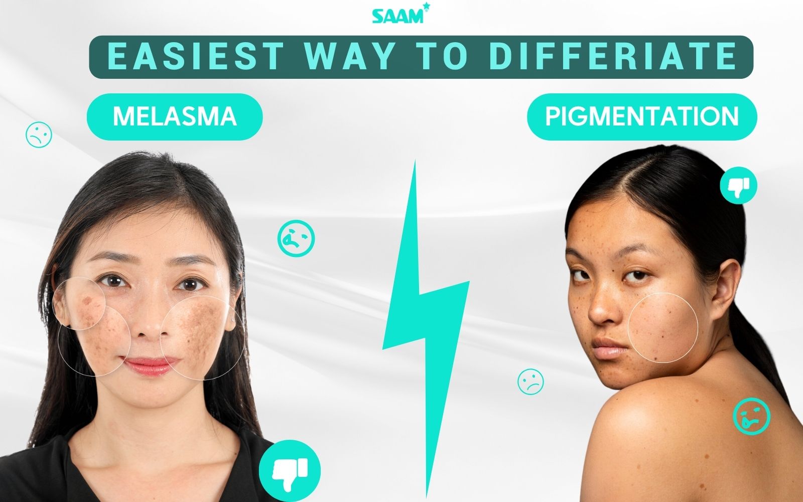 The easiest way to differentiate melasma and pigmentation (1)
