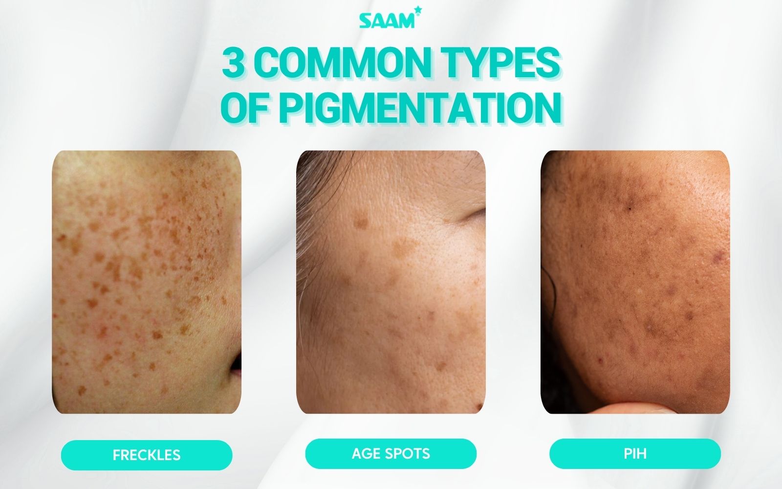 Three common types of pigmentation (1)