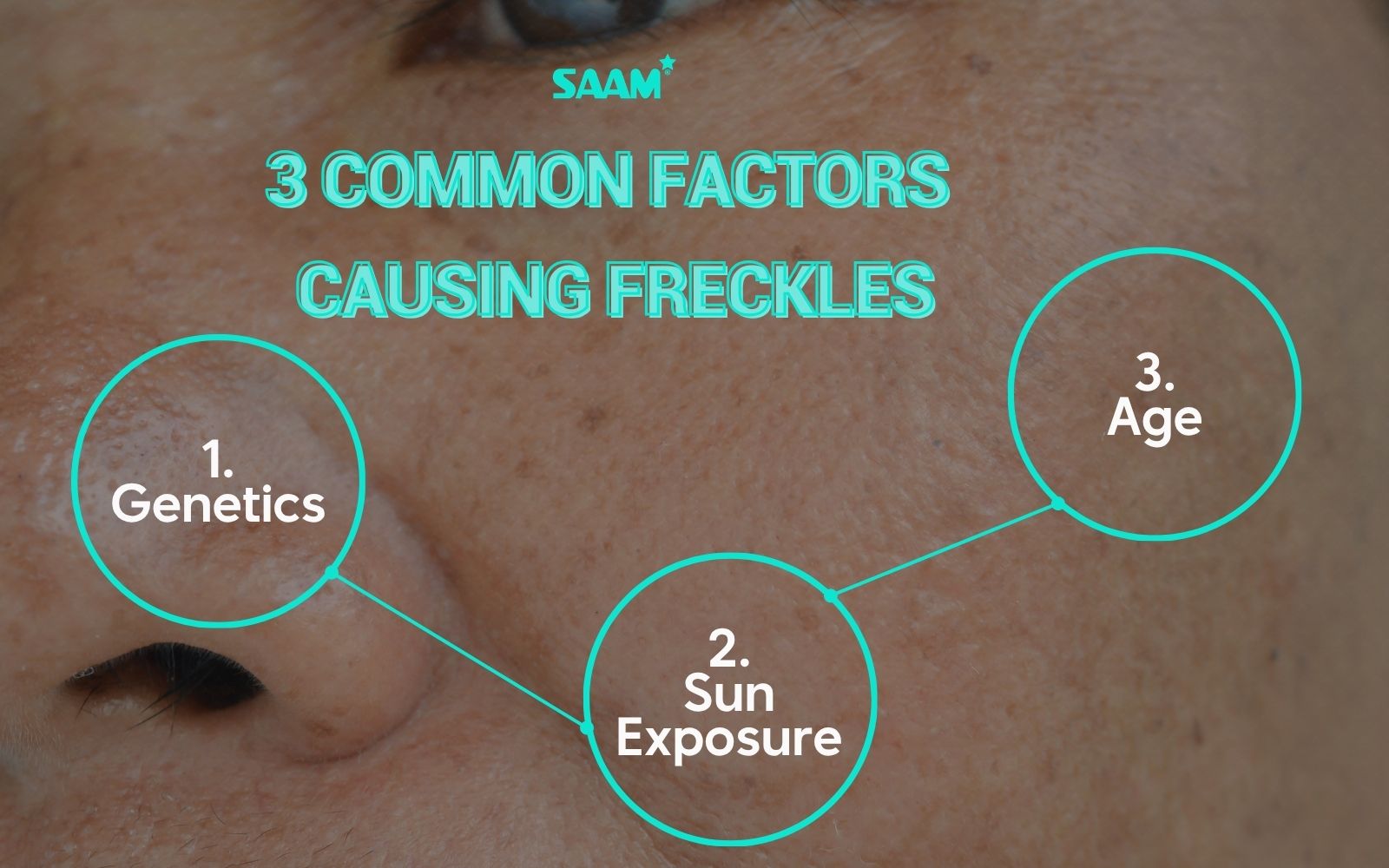 Understanding melanin and freckles causes for better treatment (1)