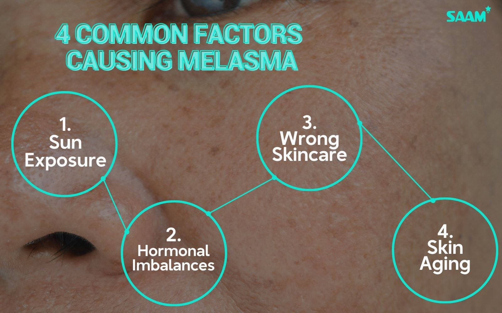 Understanding melanin and freckles causes for better treatment (2)