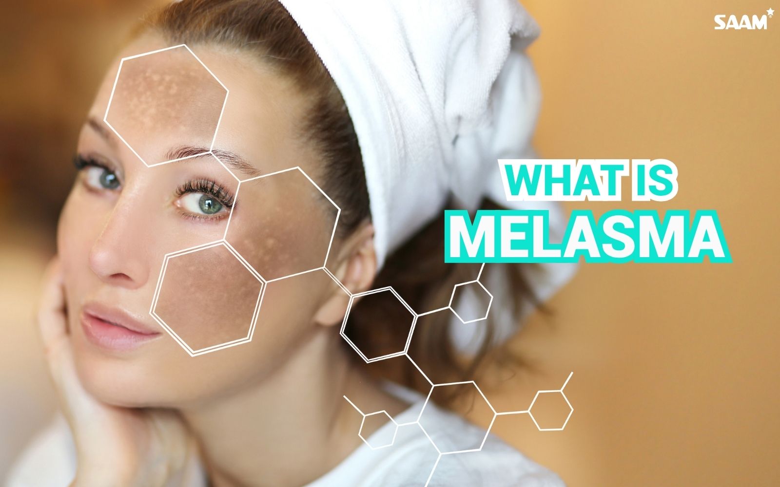 Understanding melasma and find suitable solution to treat them