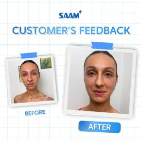 SAAM ACNE SERUM - Image 4