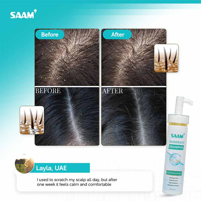 DANDRUFF SHAMPOO - Image 5