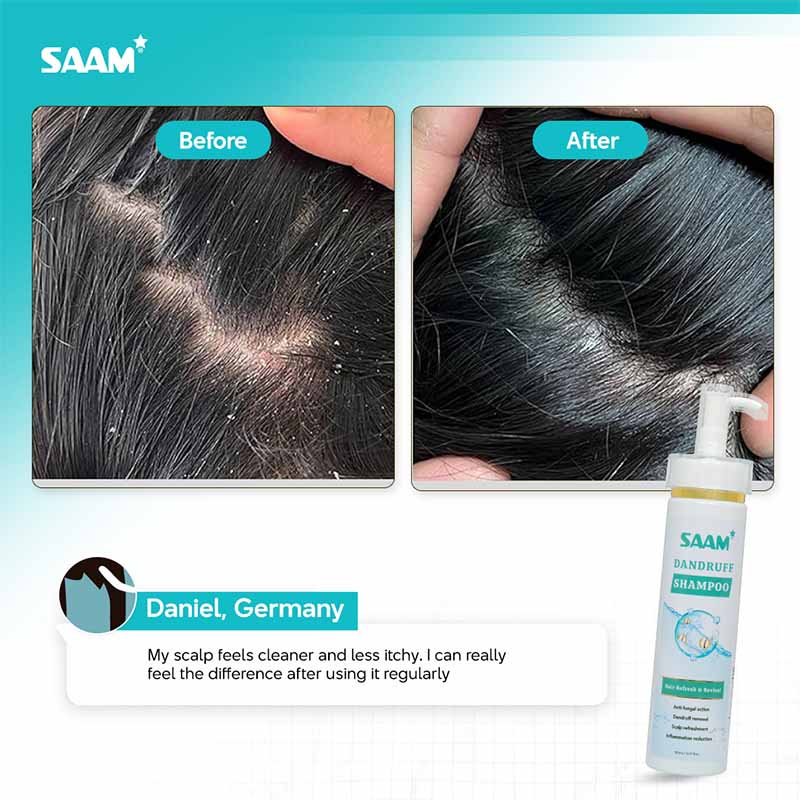 DANDRUFF SHAMPOO - Image 6