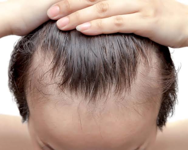 Hairline