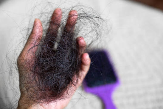 All Over Scalp