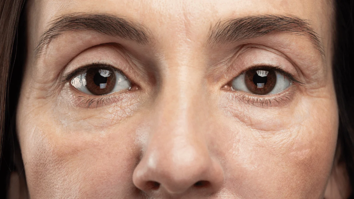 Entire Eye Area