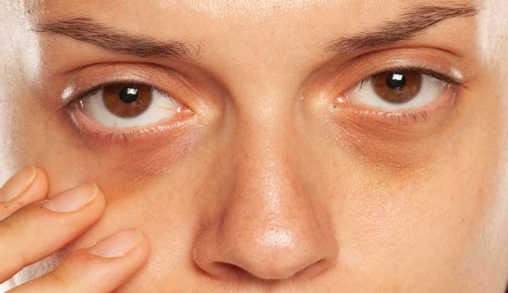 Under Eyes