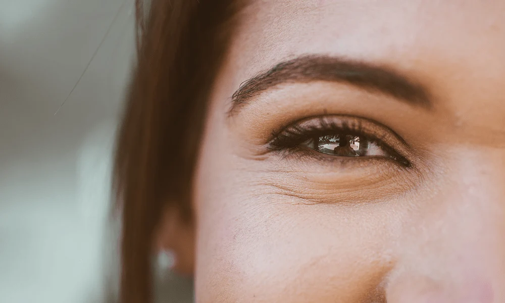 Upper Eyelids