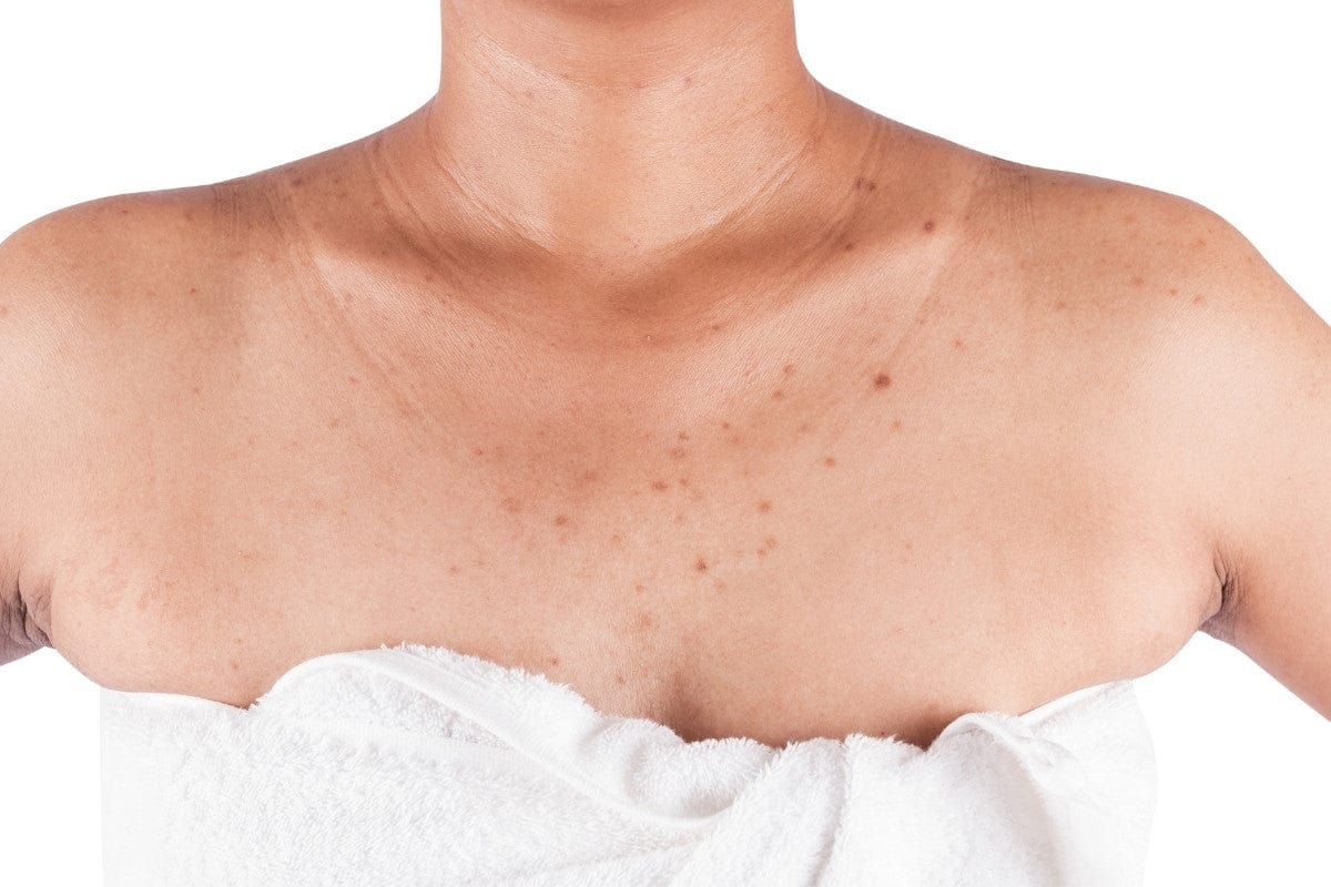 Underarms