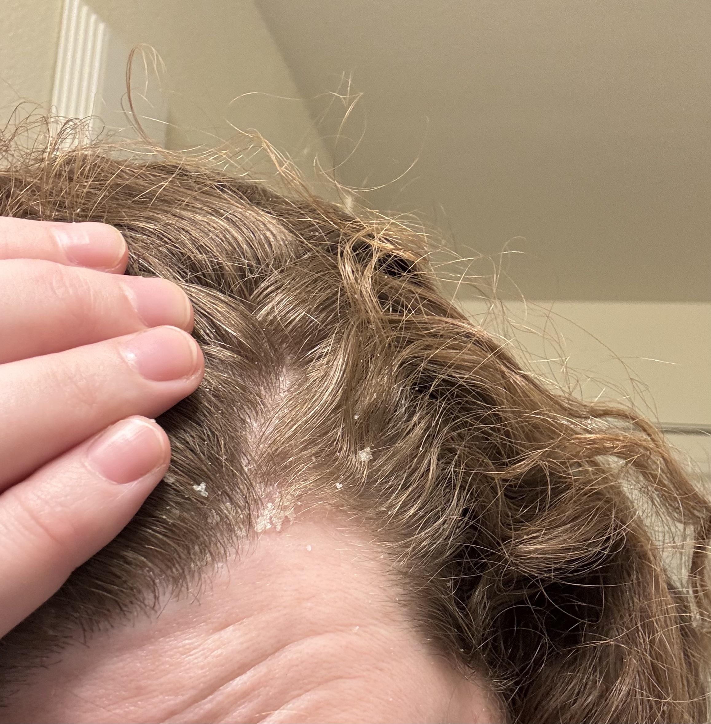 Hairline